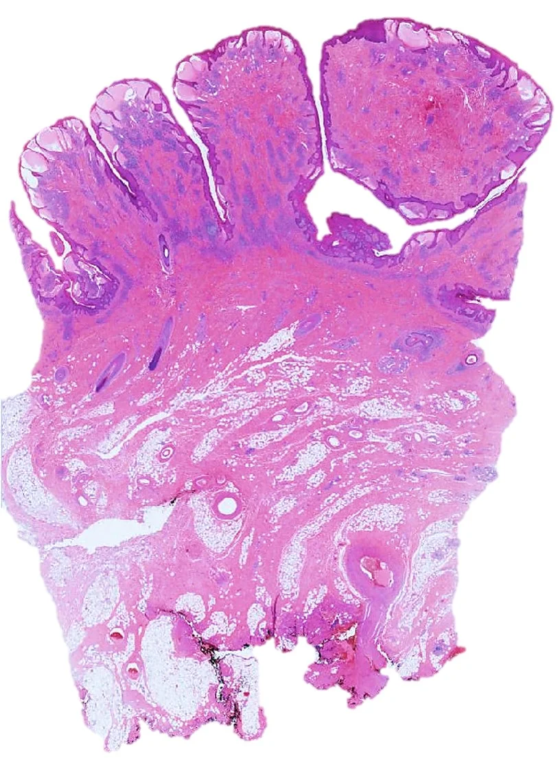 Case19_2.jpg