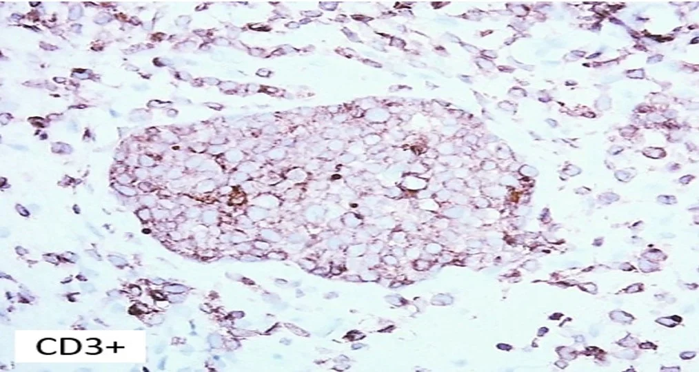 Case21_8.jpg