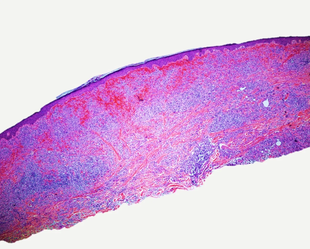 Case10b_3.jpg