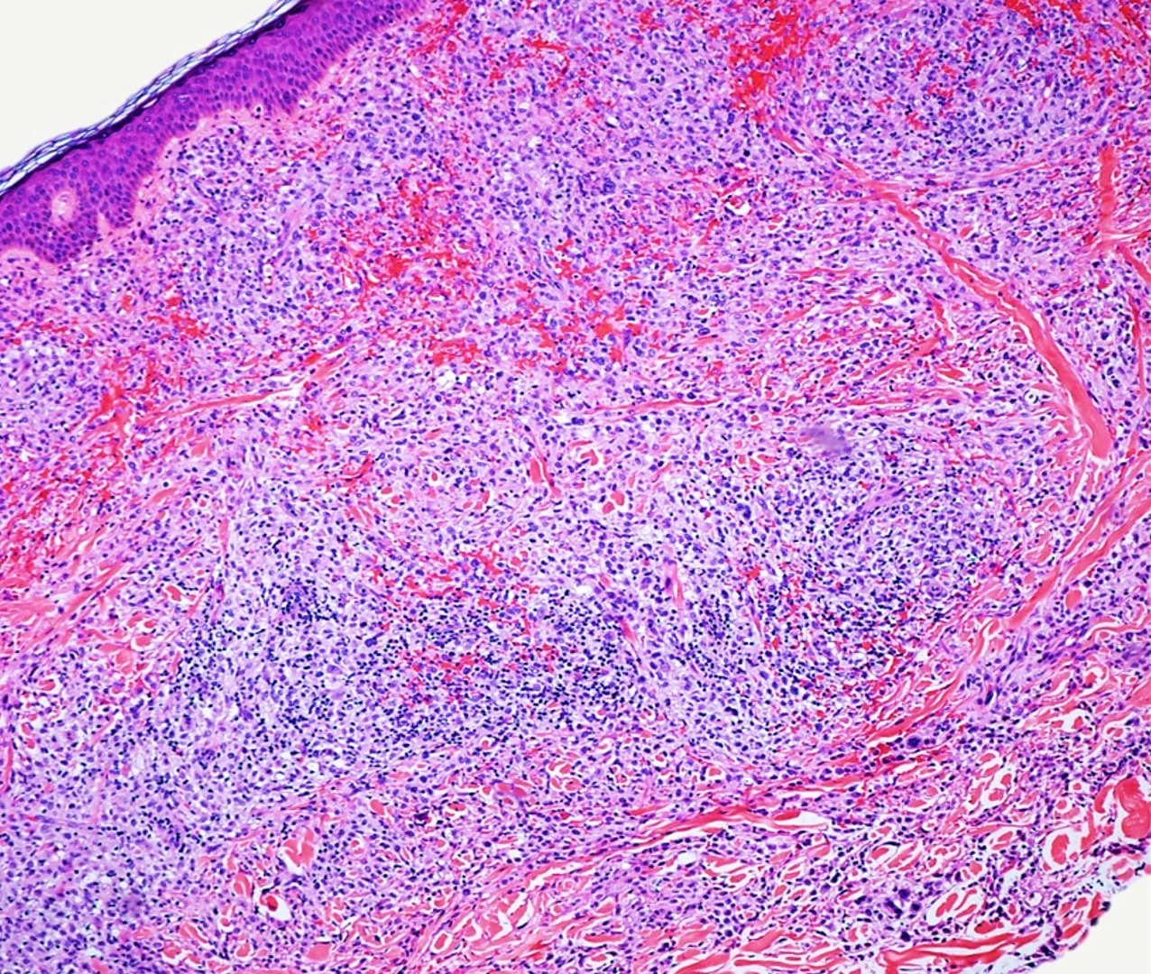 Case10b_4.jpg