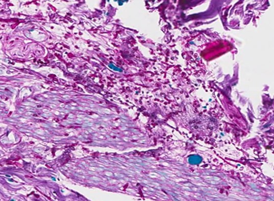 Case35-7.jpg