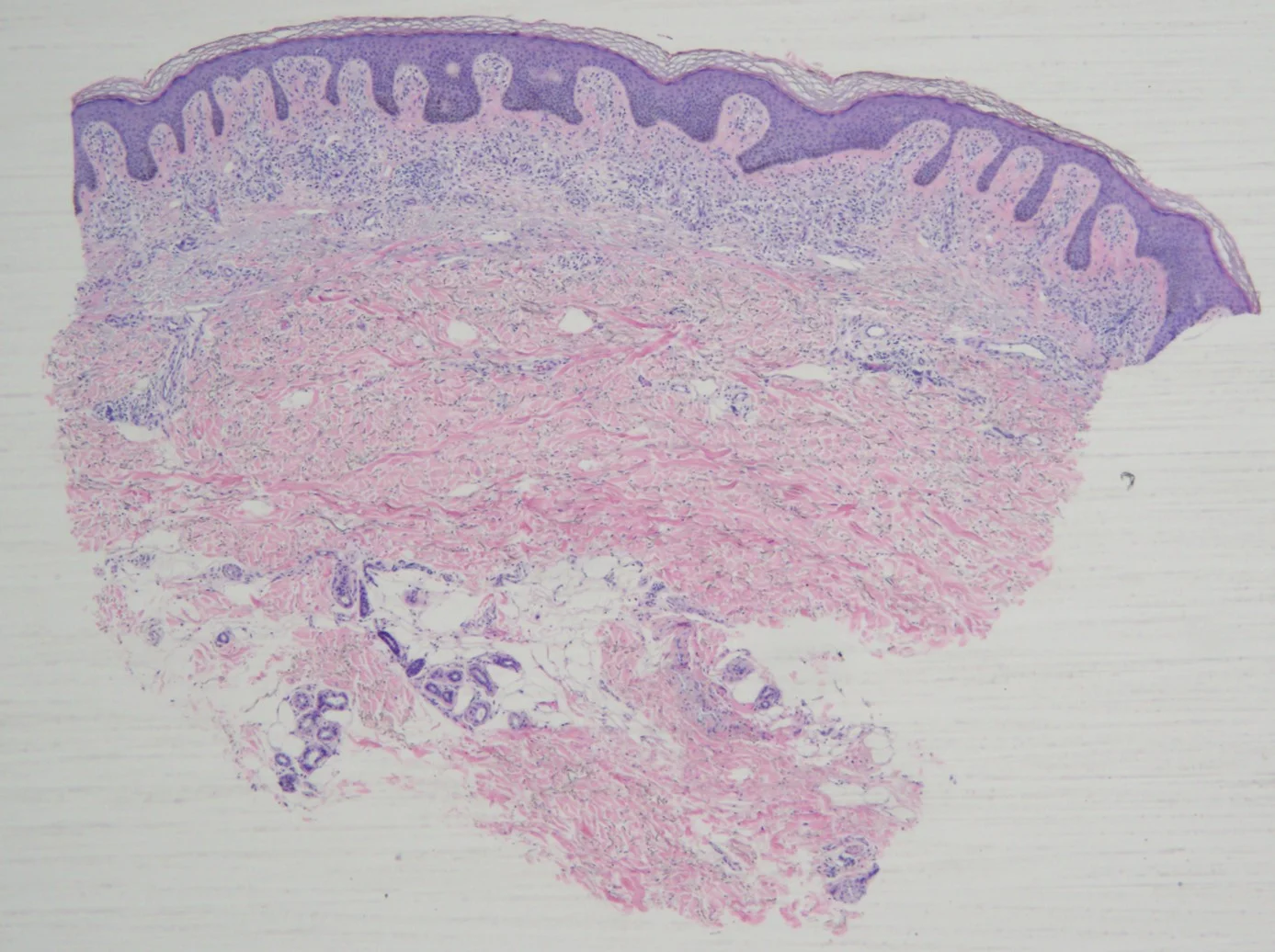 Case31-4.jpg