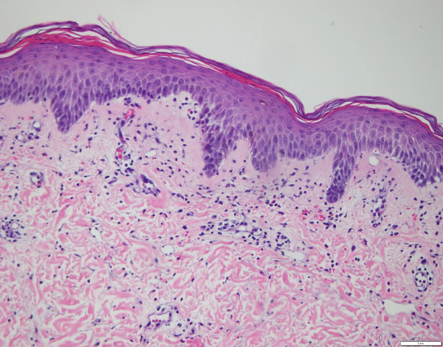 Case30-11.jpg