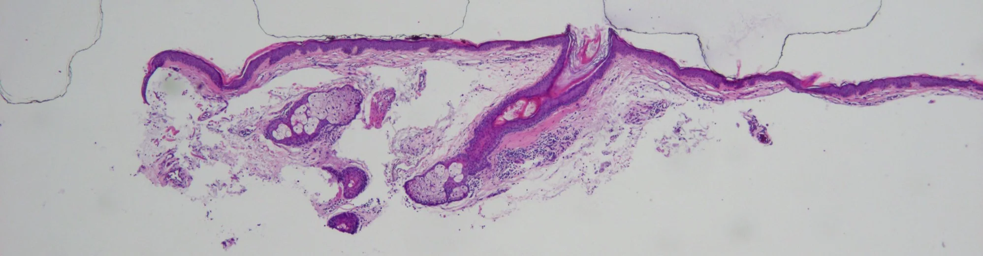 Case28-2.jpg