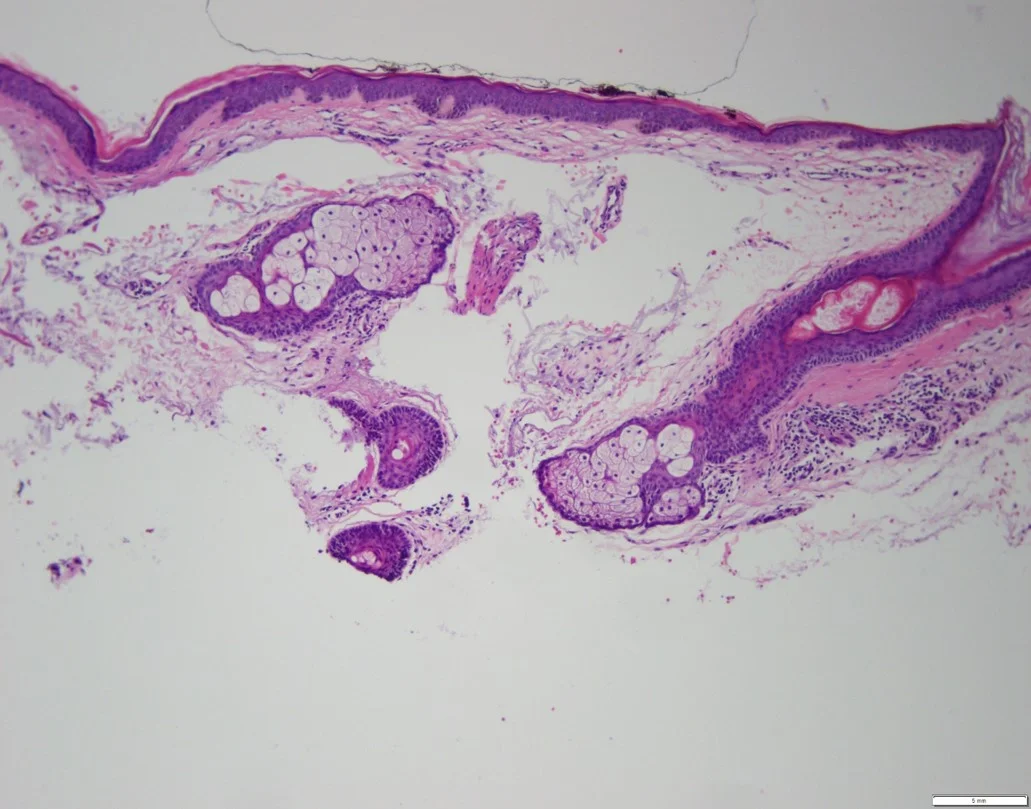 Case28-3.jpg