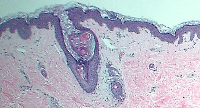 Case27-3.jpg