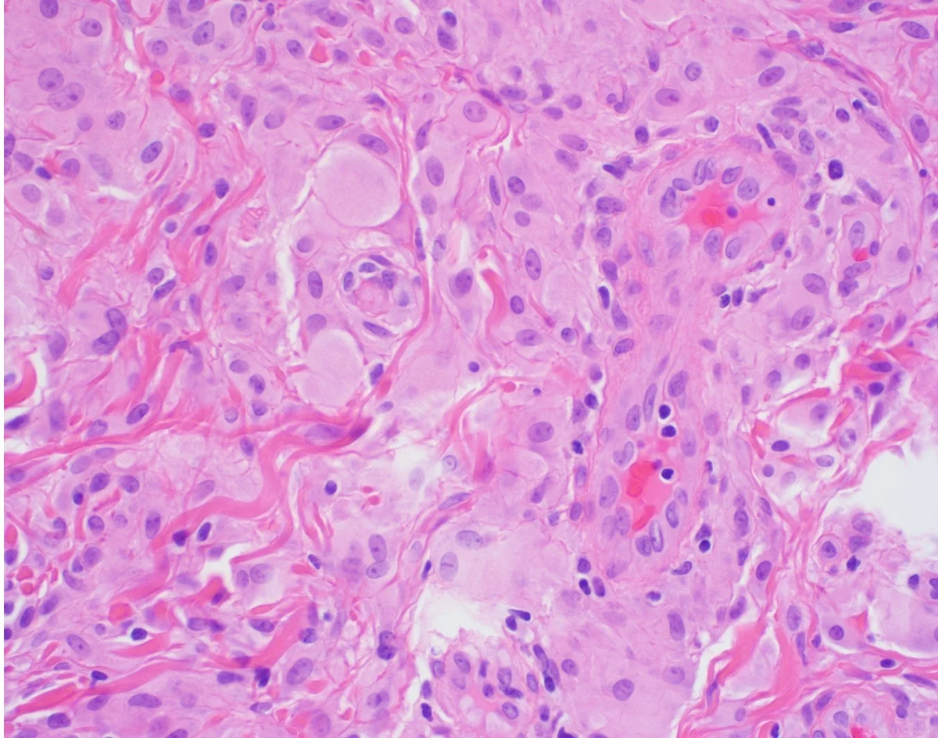 Case25-13.jpg