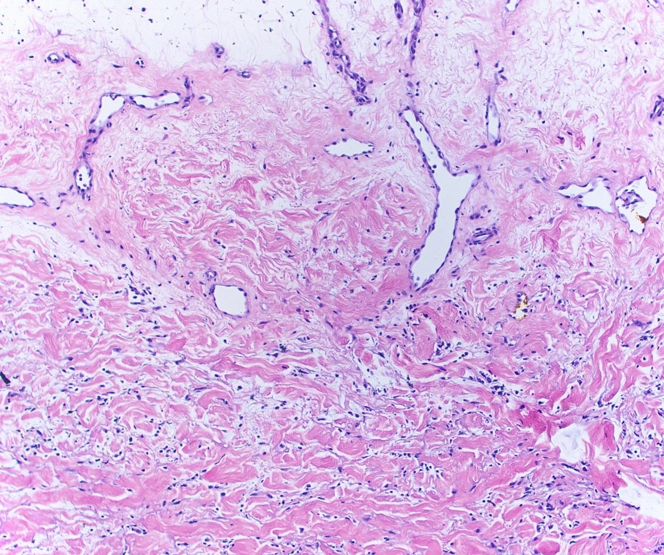 Case21b-10.jpg