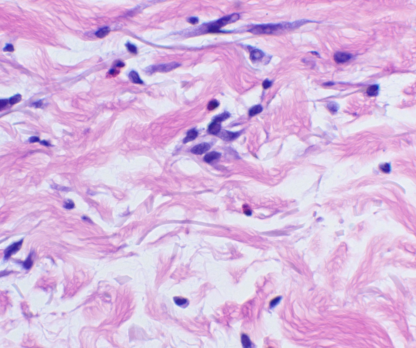 Case21b-13.jpg