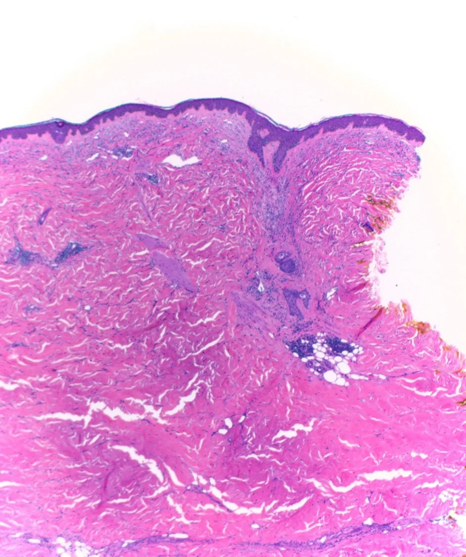 Case21b-16.jpg