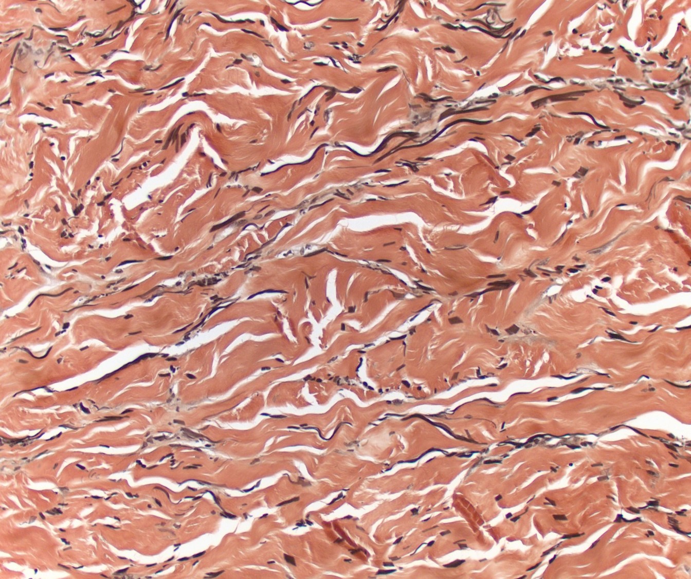 Case21b-22.jpg