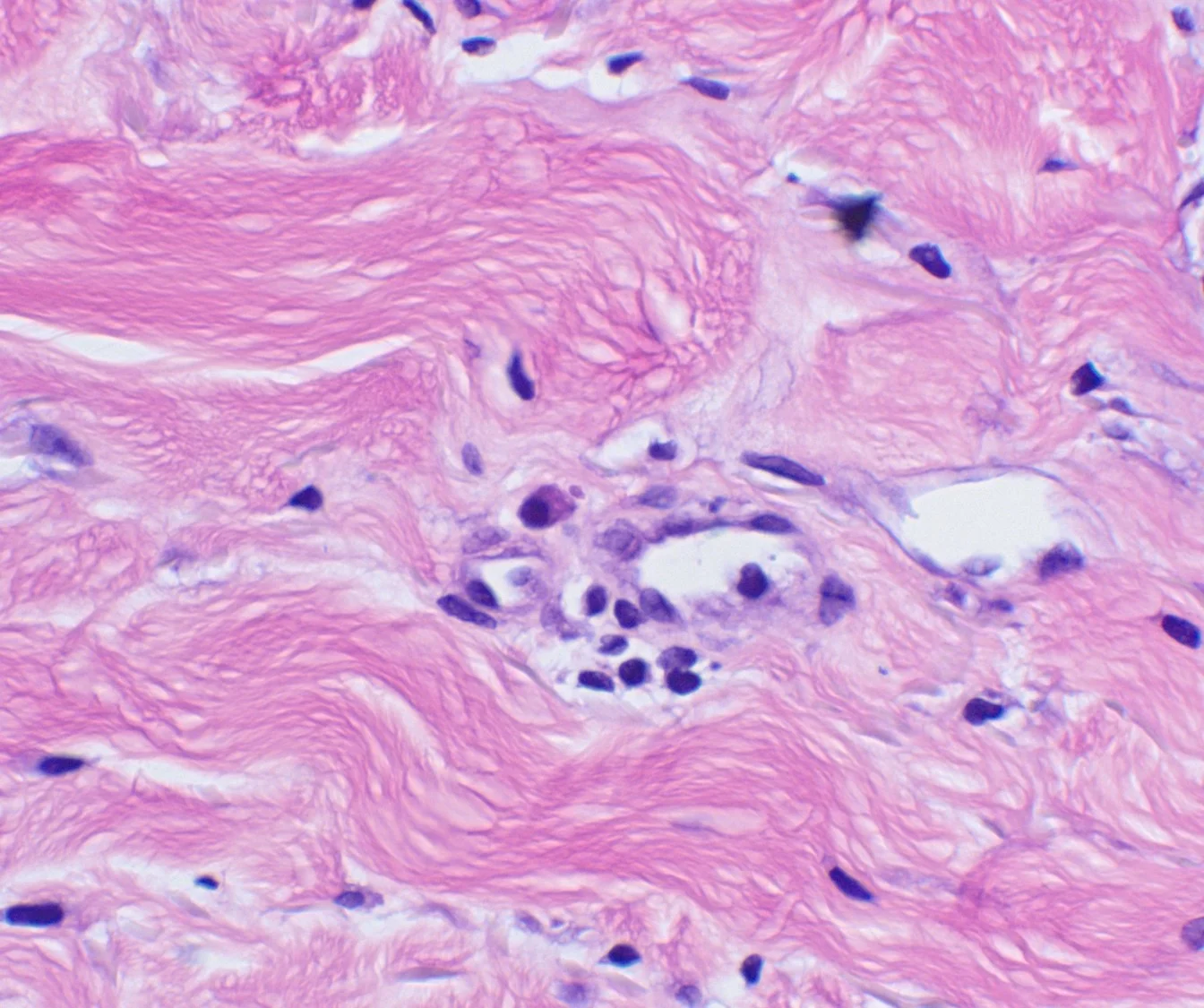 Case21b-14.jpg