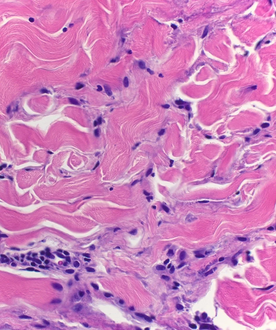 Case21b-20.jpg