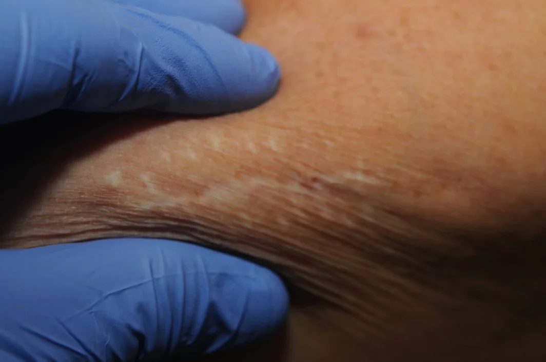 Case21a-4.jpg