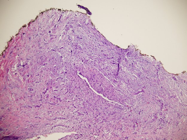 Case17-4.jpg
