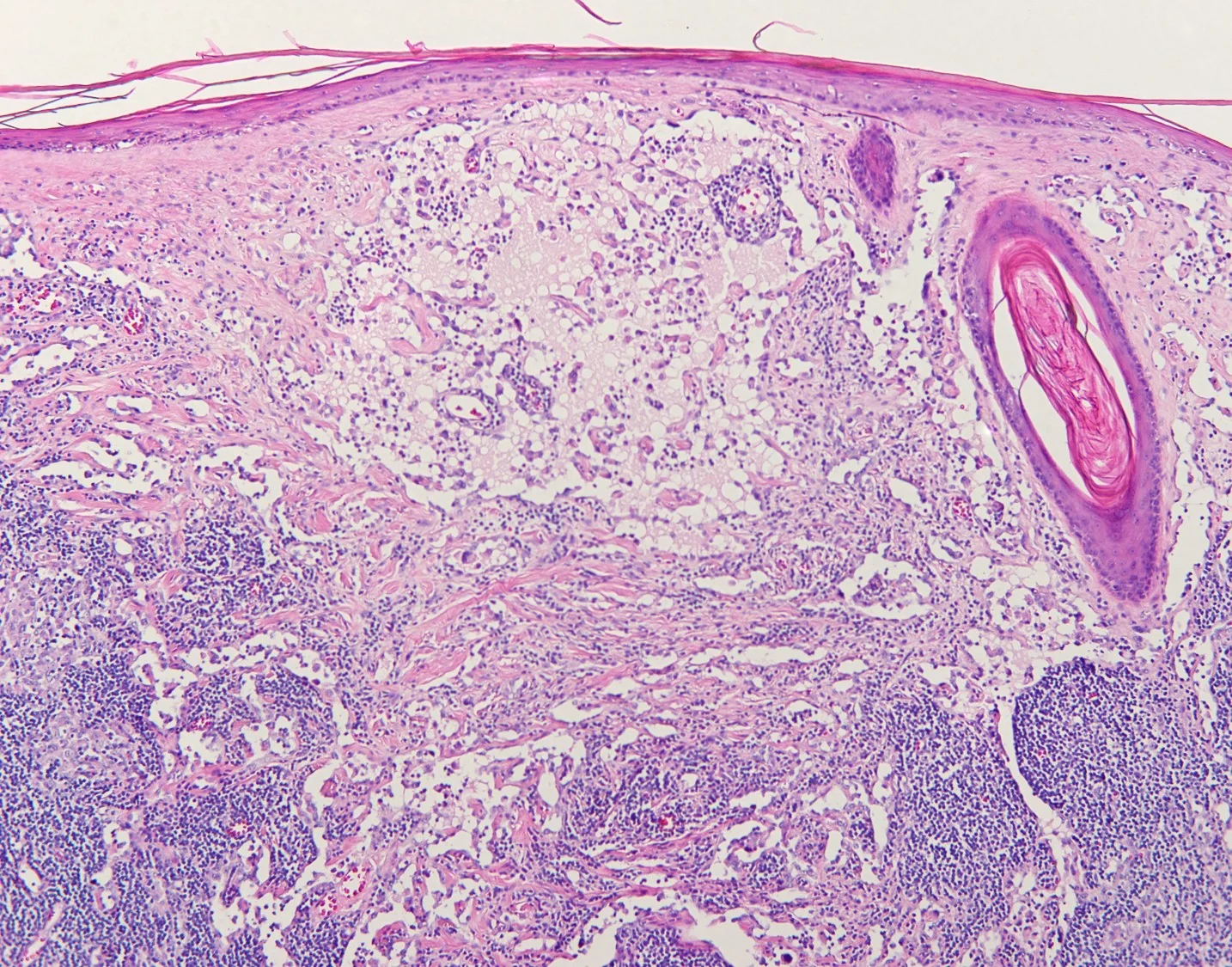 case15b-10.jpg