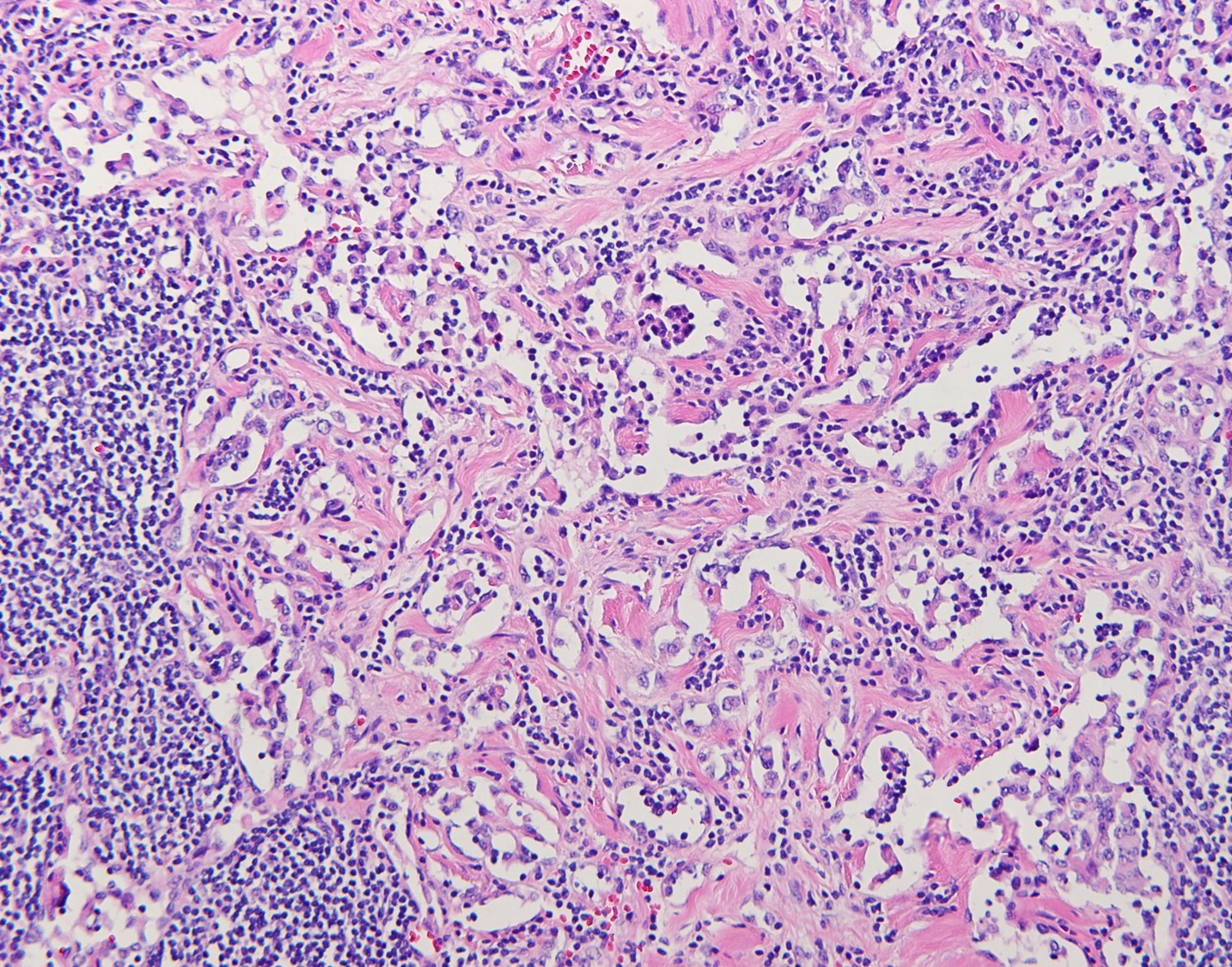 case15b-12.jpg