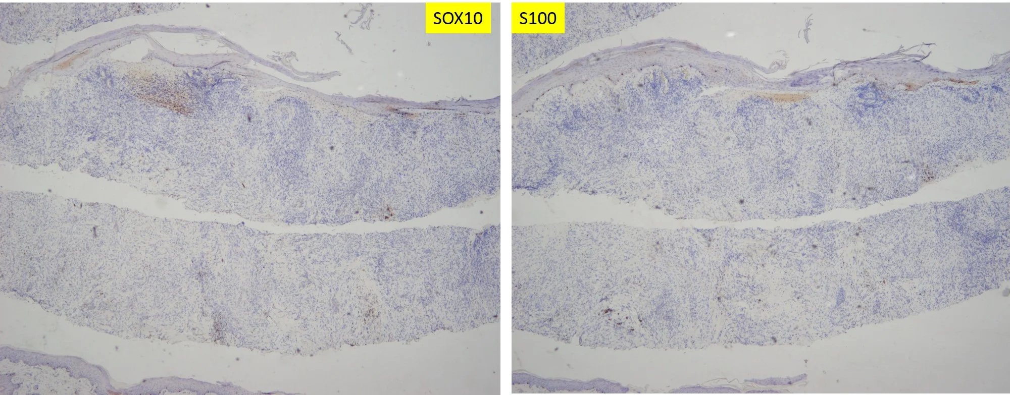 case15b-15.jpg
