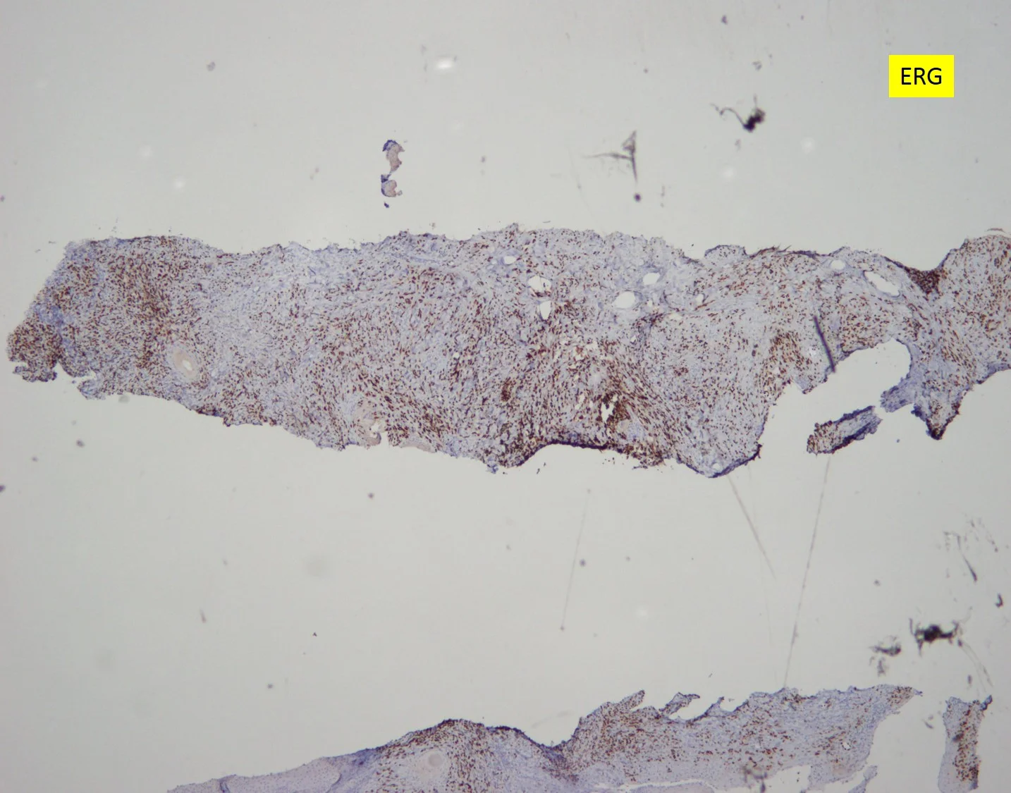 case15b13.jpg