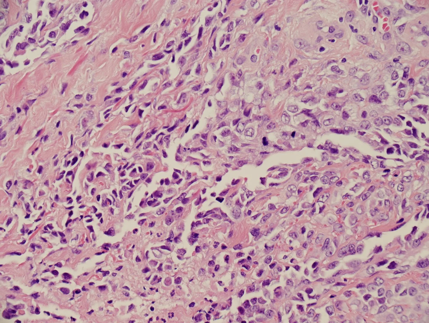 case15a-5.jpg