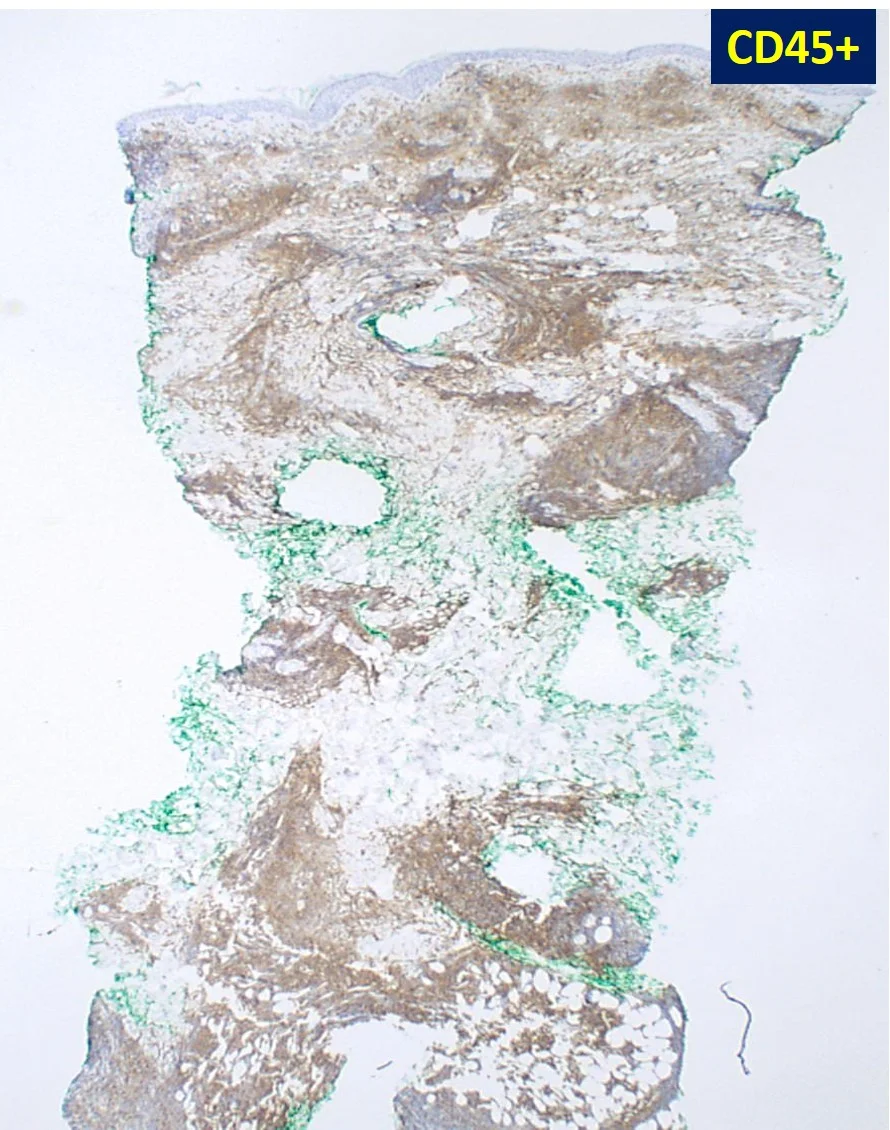 Case2-5.jpg