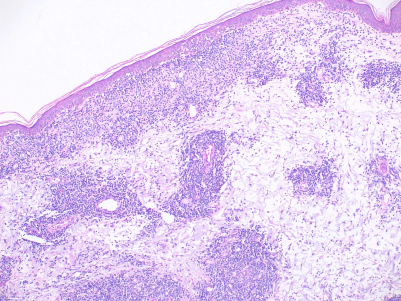 Case3a-9.jpg