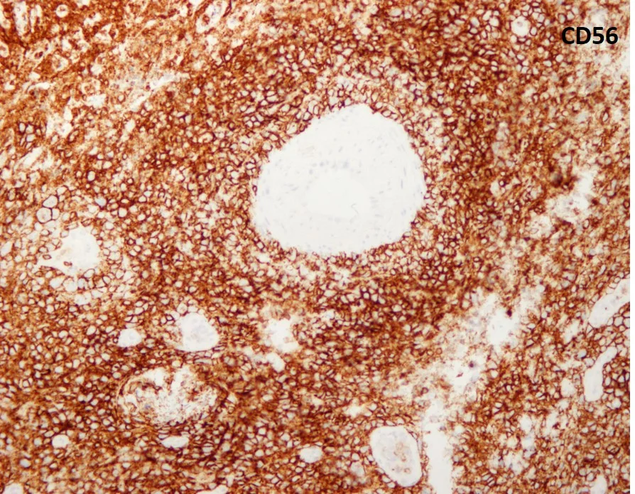case3b-12.jpg
