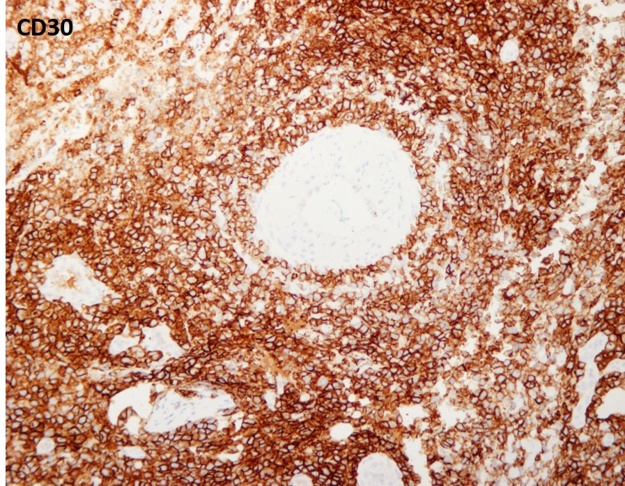 case3b-13.jpg