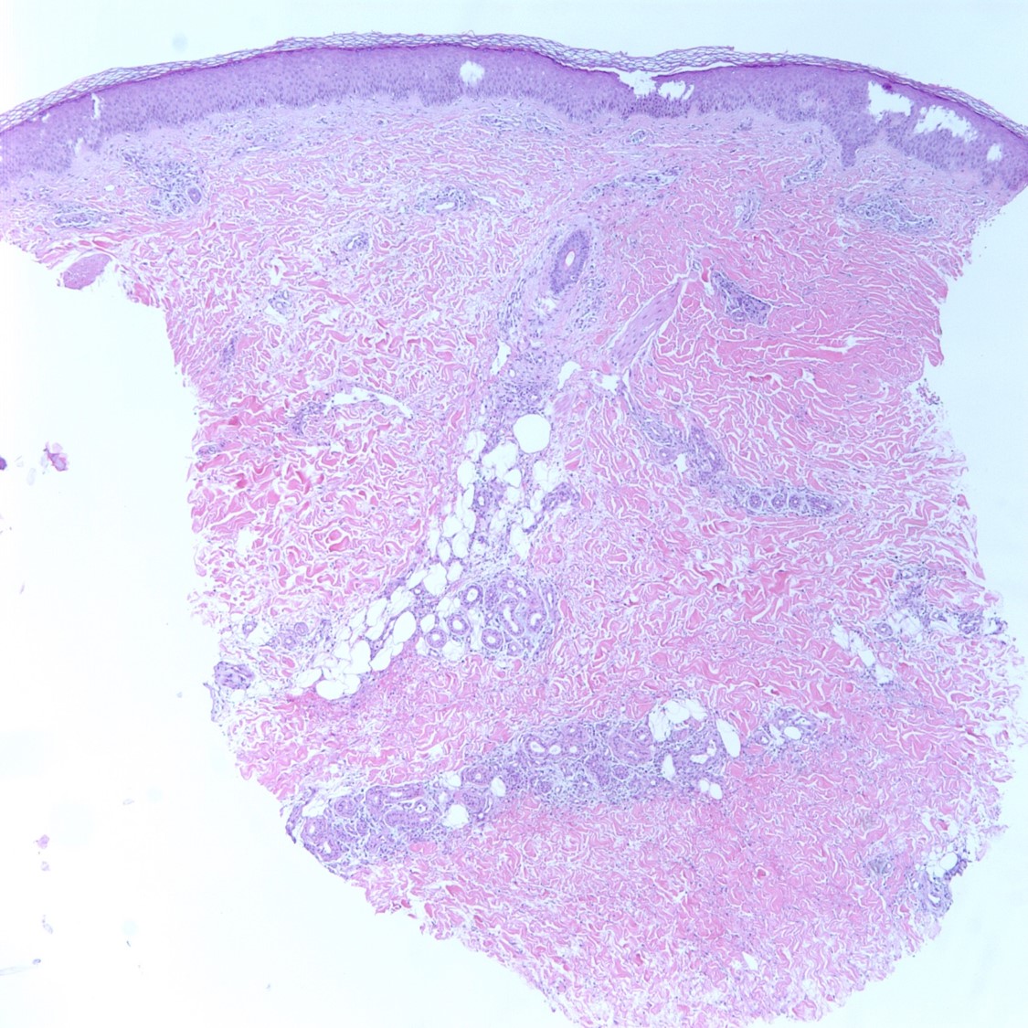 case4b-3.jpg