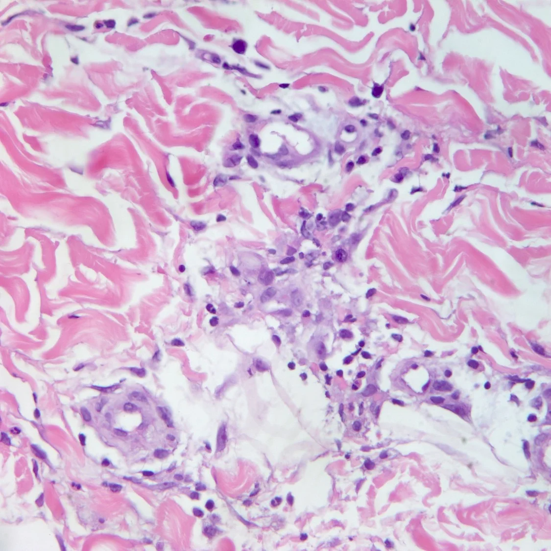 case4b-6.jpg