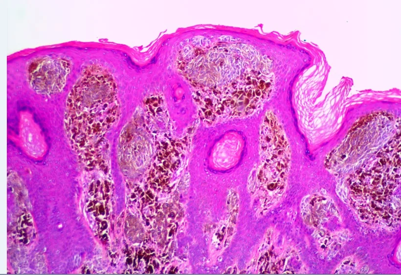 case5b-2.jpg