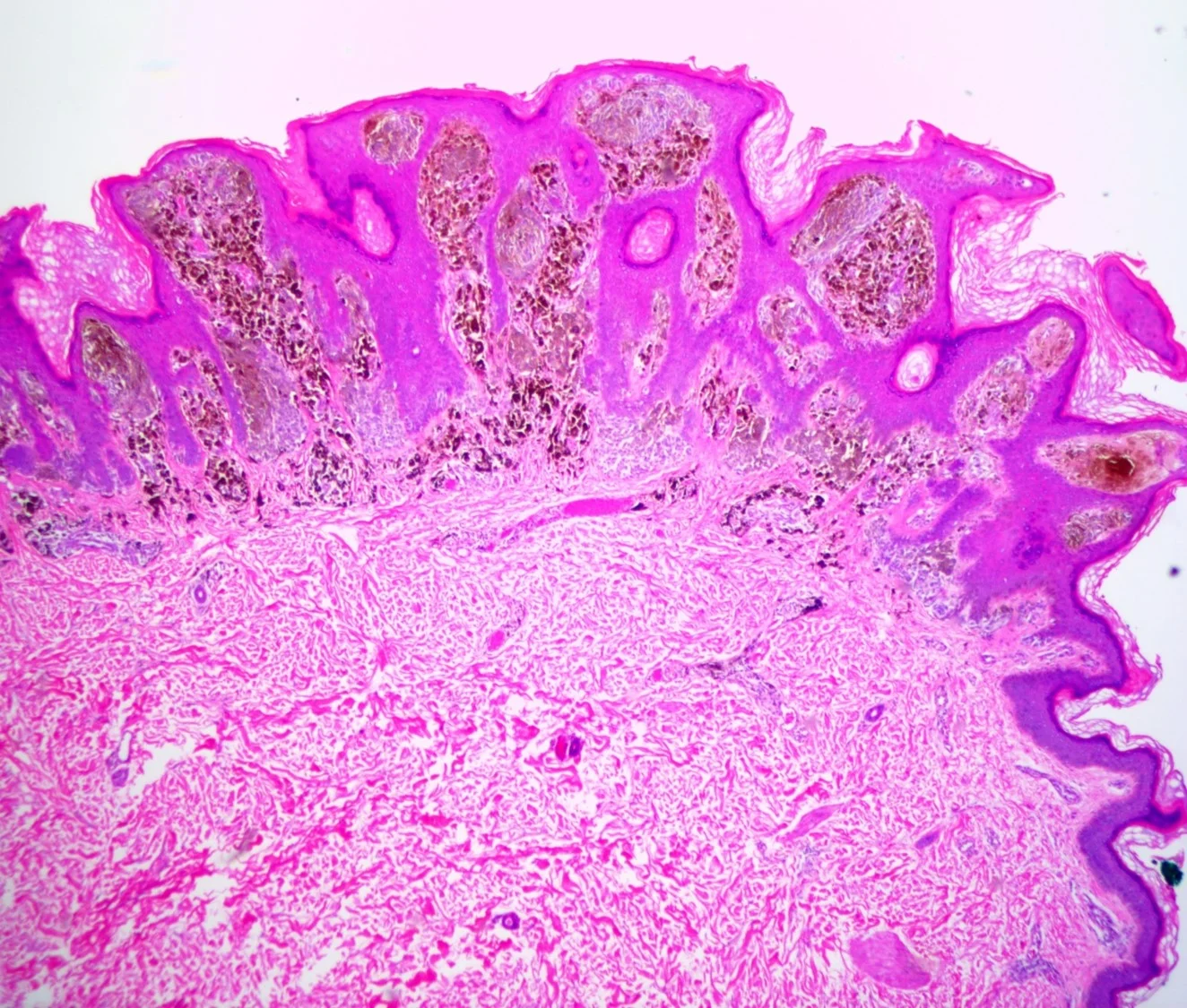 case5b-1.jpg