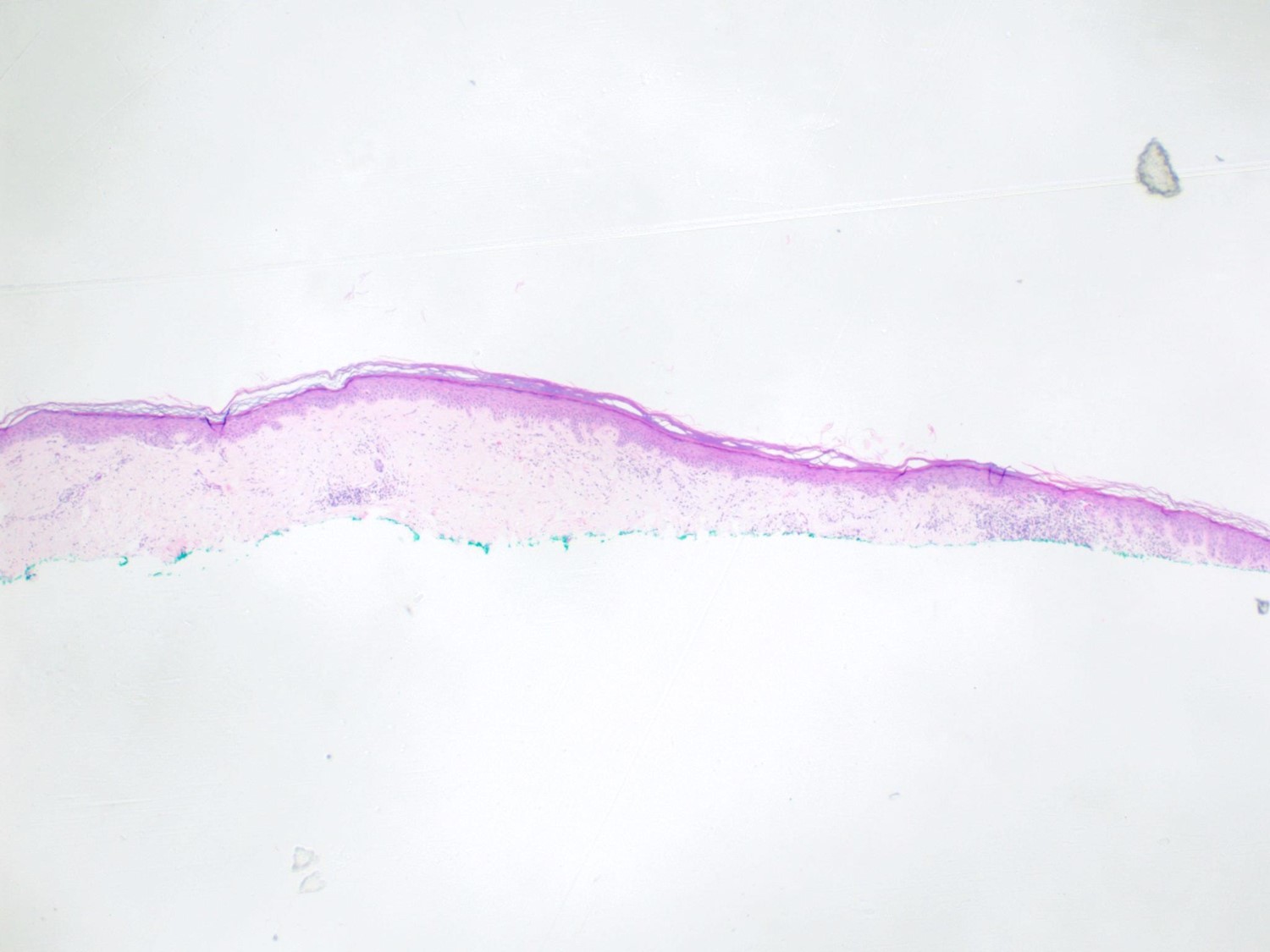 case6-2.jpg