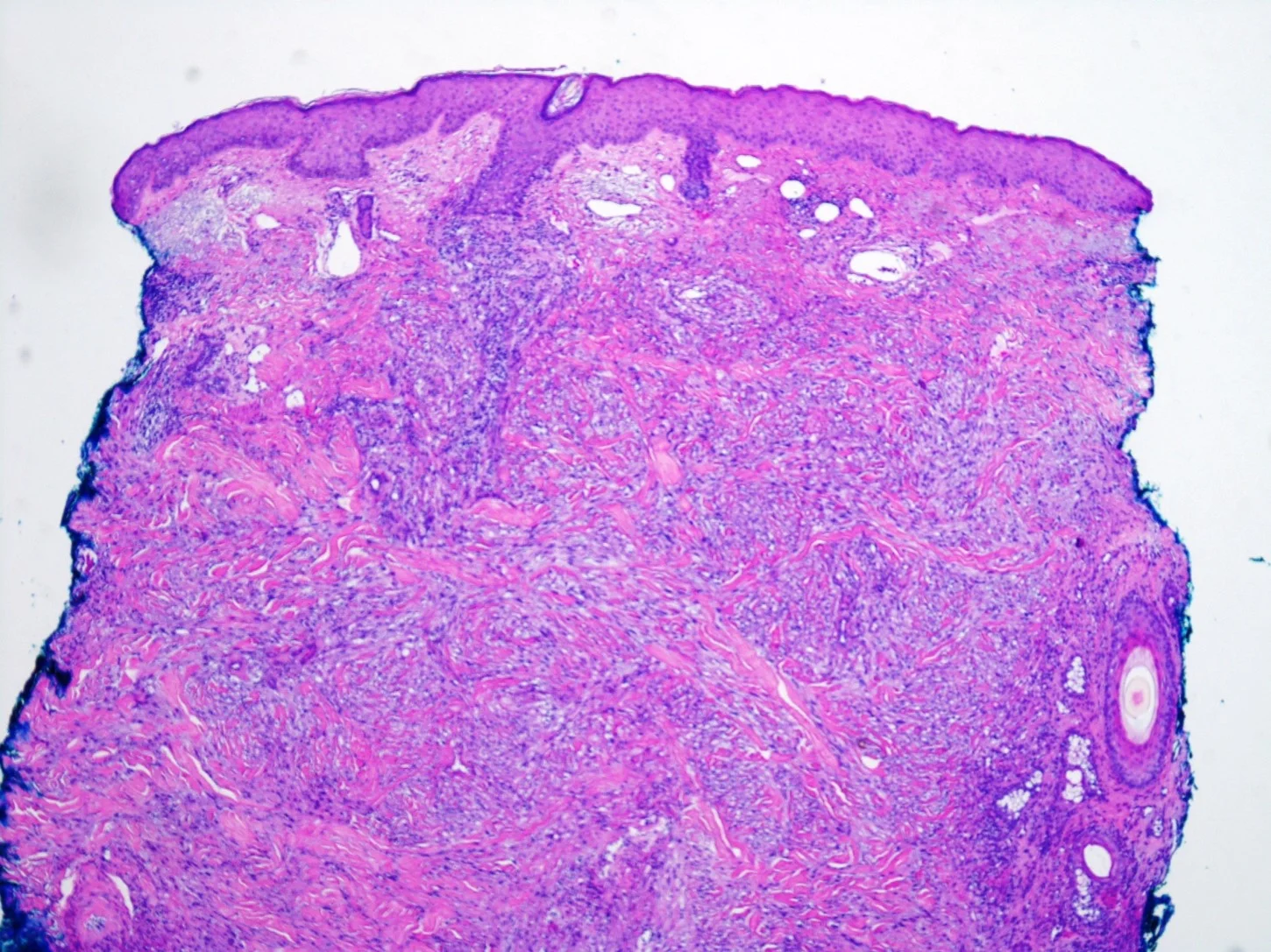 case11-4.jpg