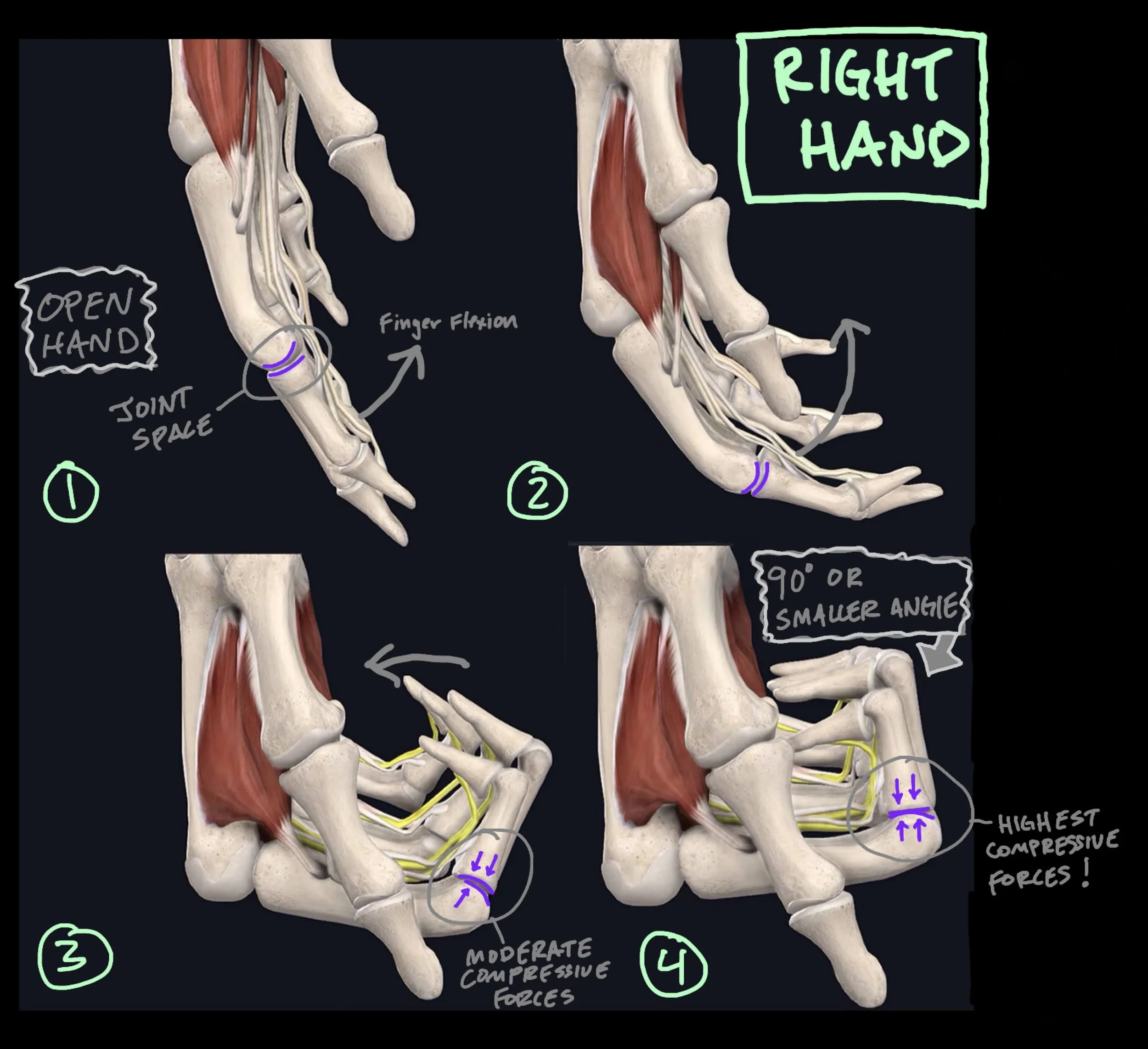 Are You Overdoing Finger Exercises to Deal with Pain?