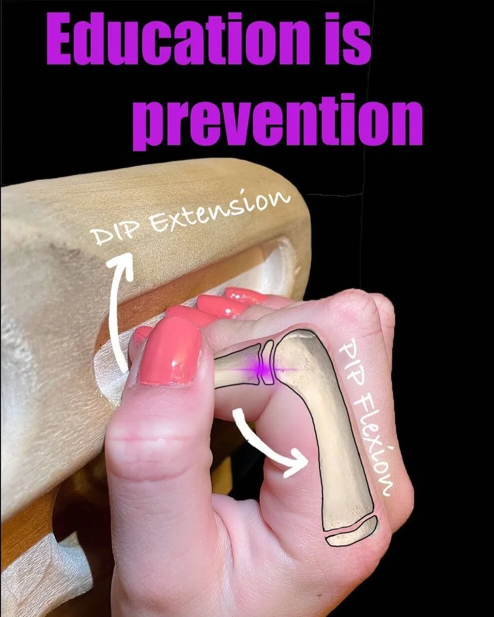 How to Prevent Finger Injuries: Expert Tips & Tricks