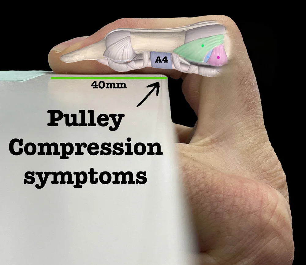 How to Prevent Finger Injuries Climbing: Expert Tips