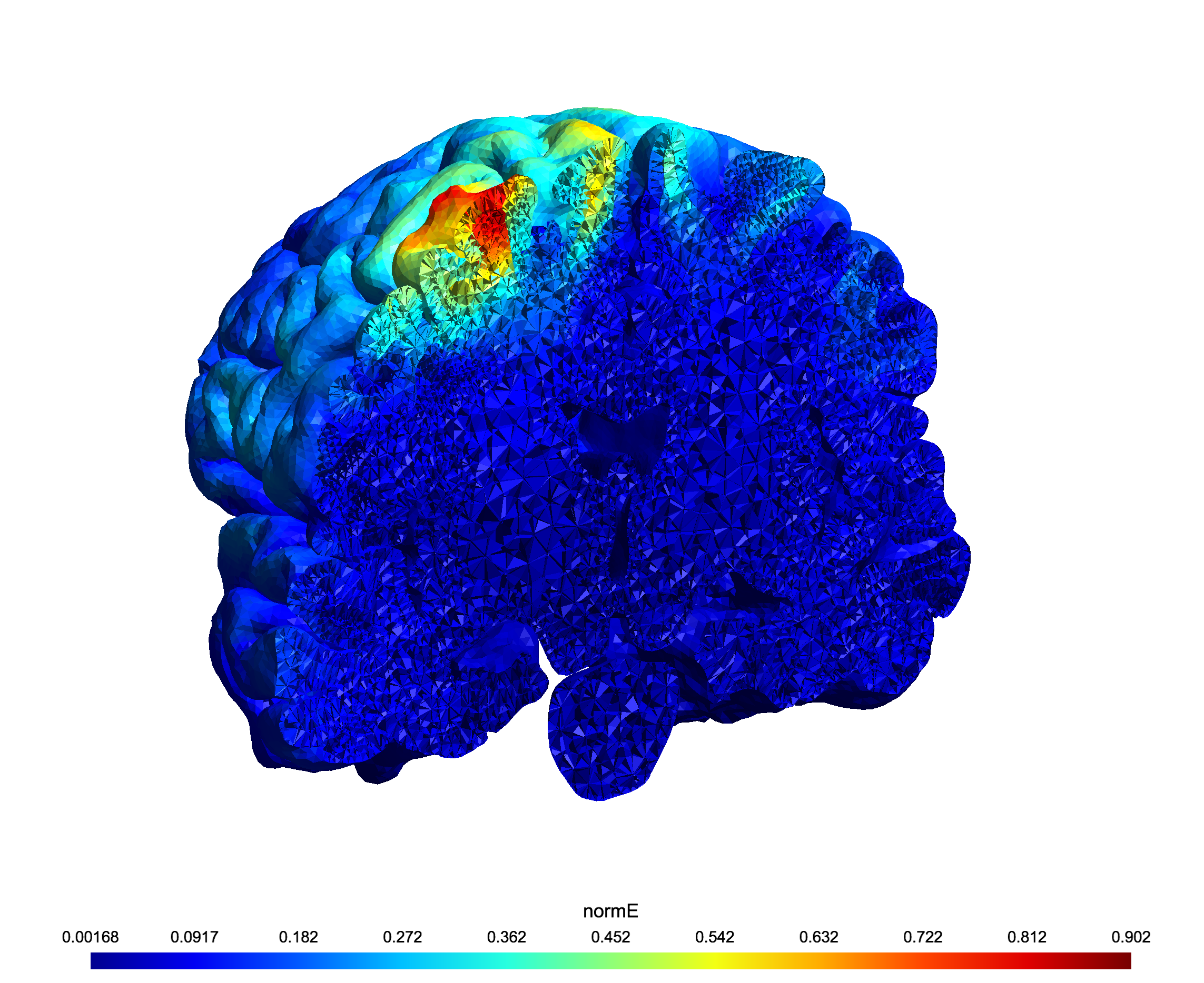 Modeled disturbance induced by TMS