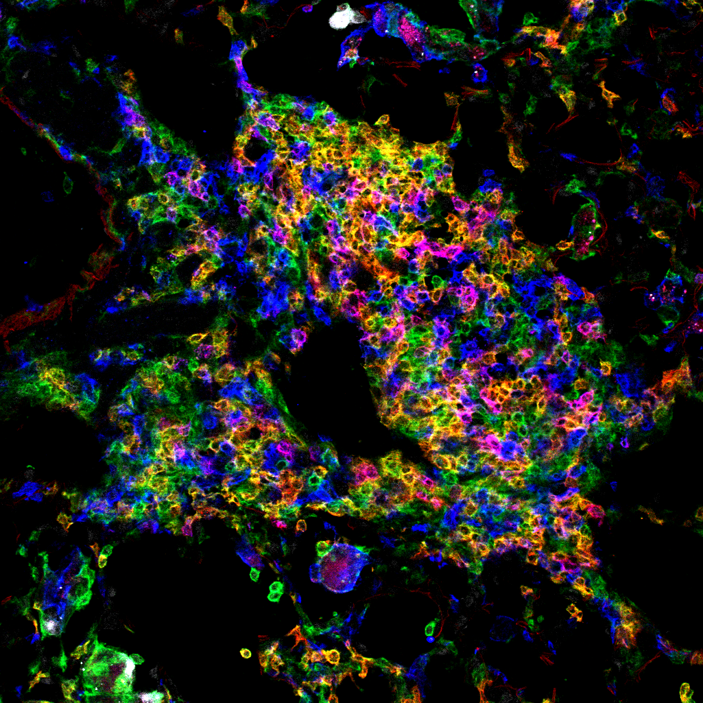 45-2-blue-CD4-red-45.1green-antigen-white.png