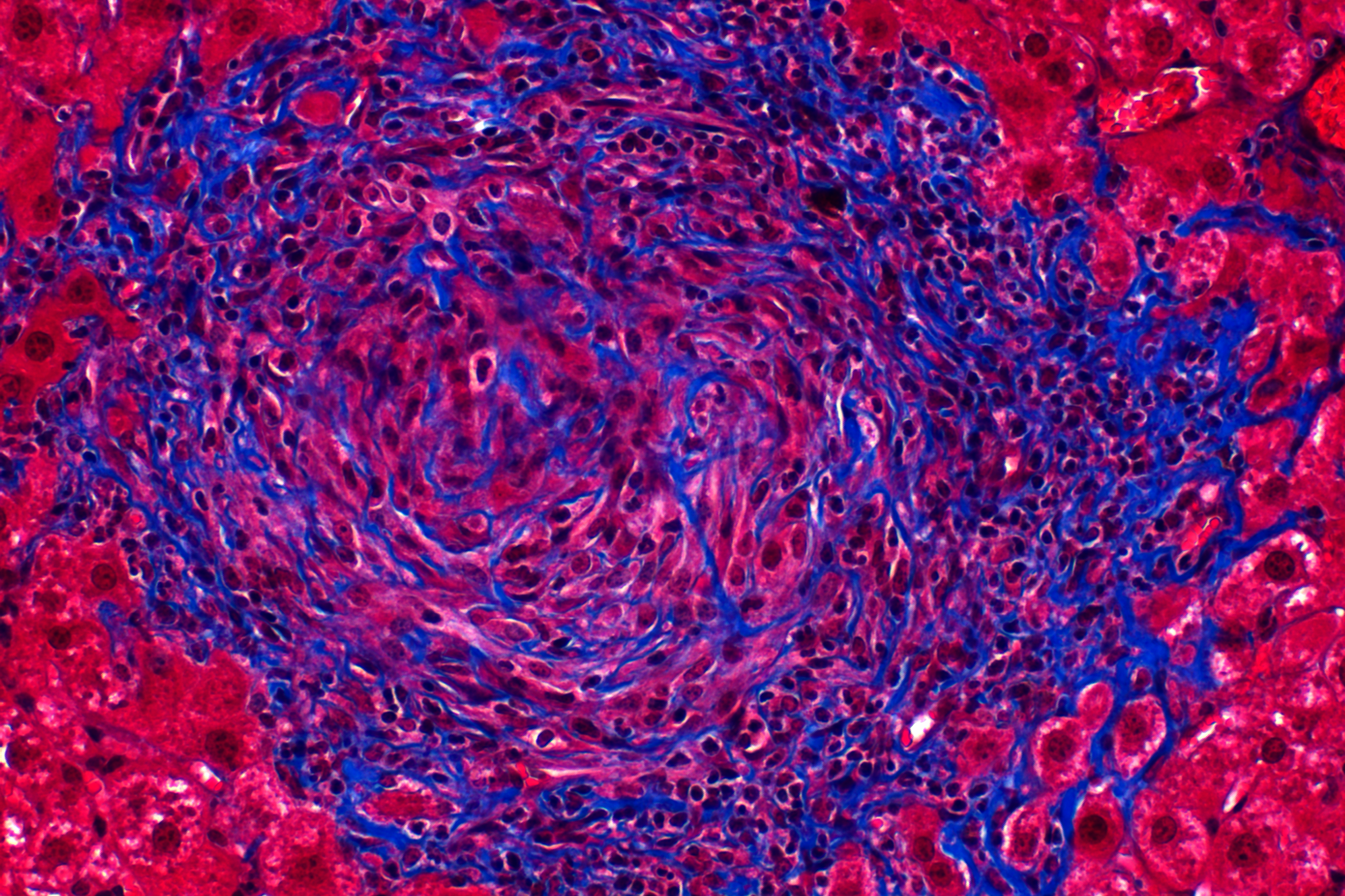 Liver-1_(c1).png