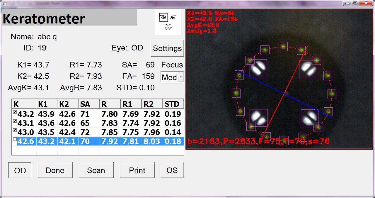PalmScan Keratometer Screen Capture