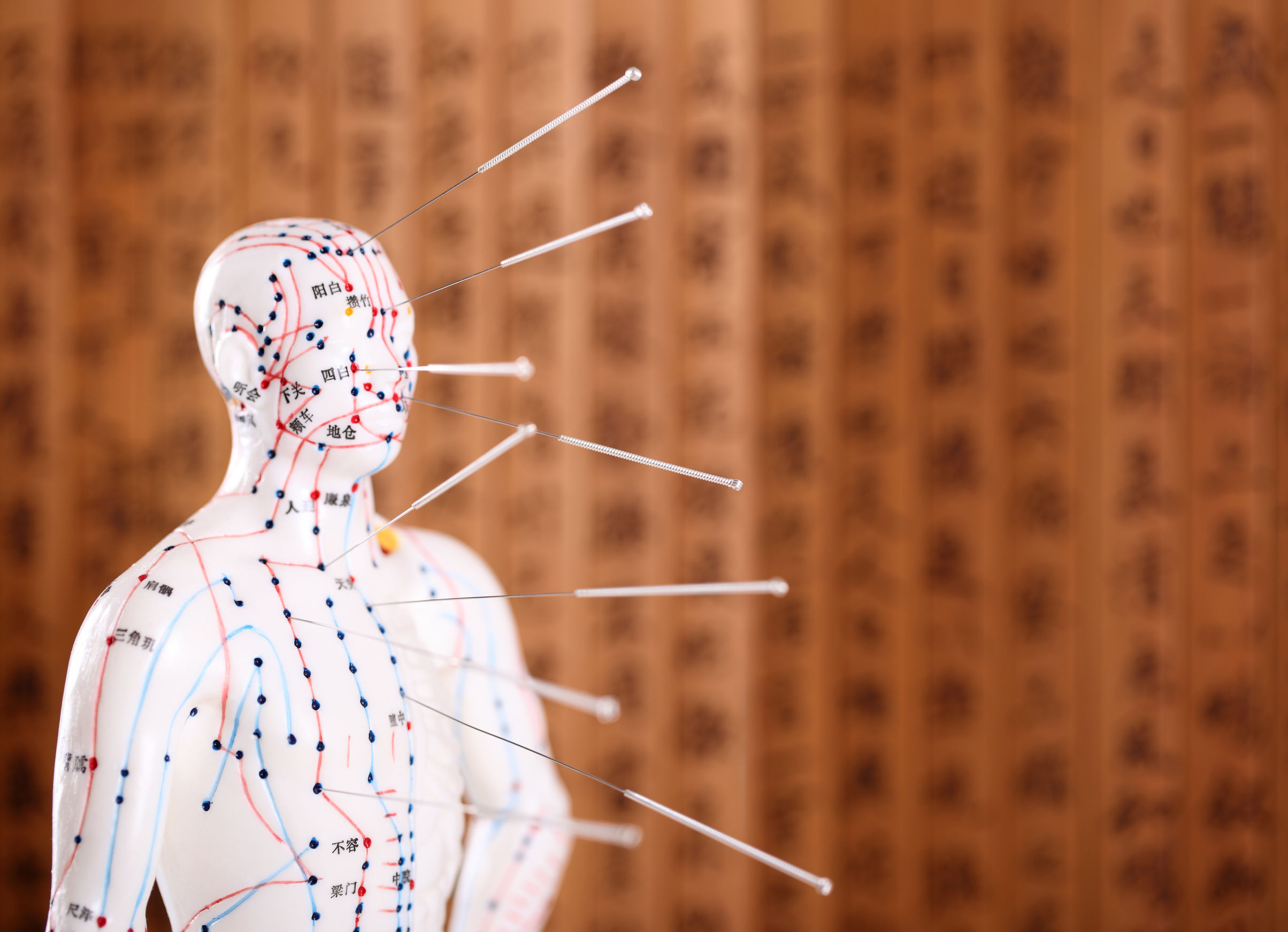 Acupuncture In Flagstaff Az Acupuncture In Flagstaff Az