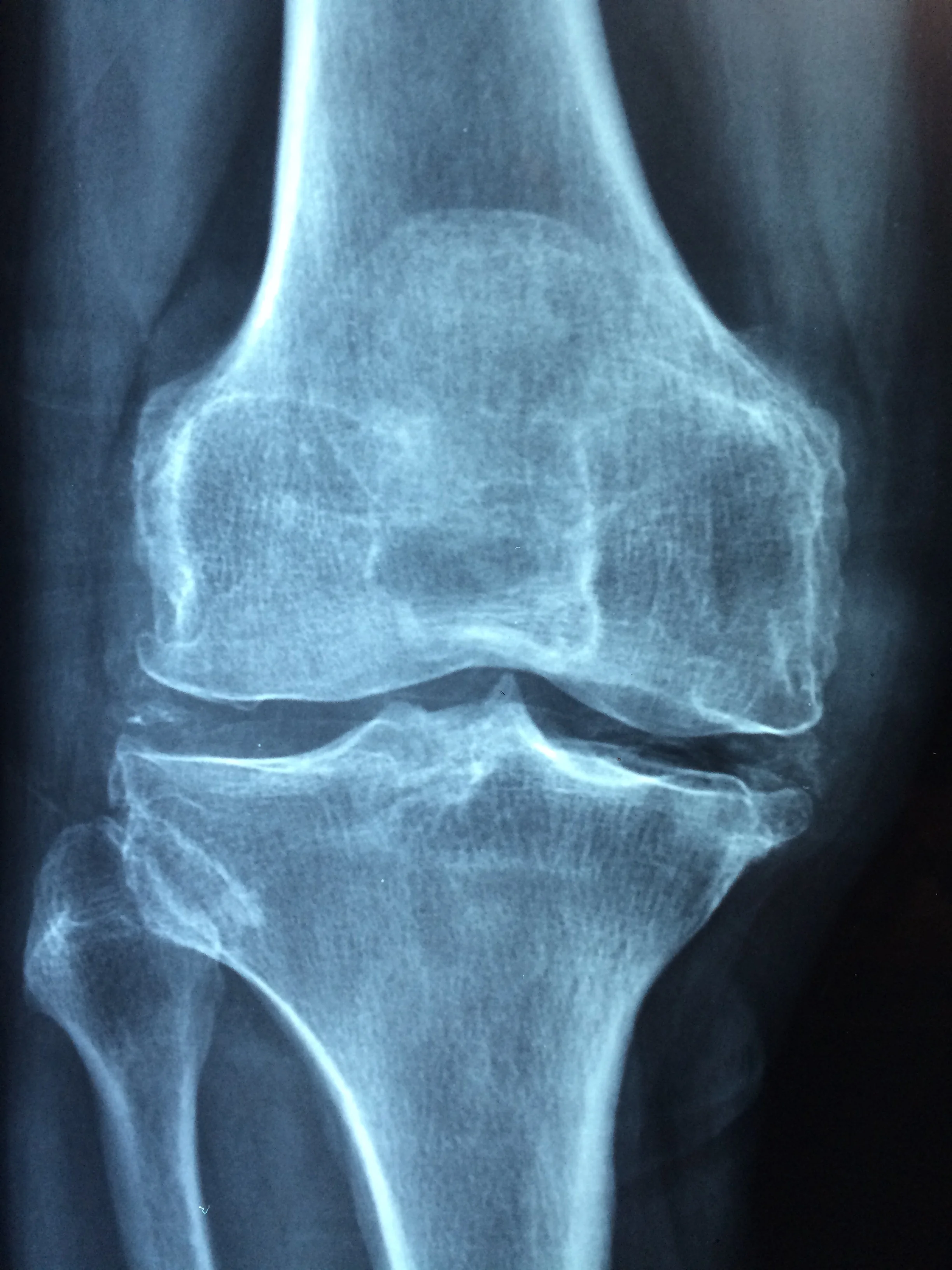 hand-trunk-old-leg-human-care-619689-pxhere.com.jpg