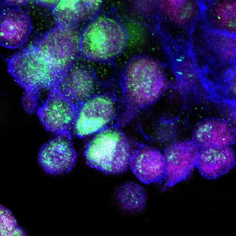 Discogenic Cells.jpg