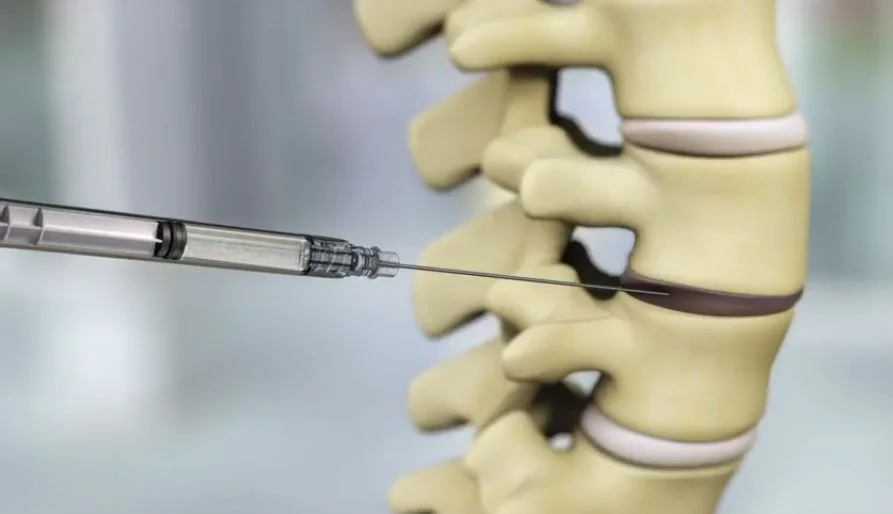 DiscGenics Announces First Patient Treated in U.S. Clinical Trial of IDCT for Degenerative Disc Disease