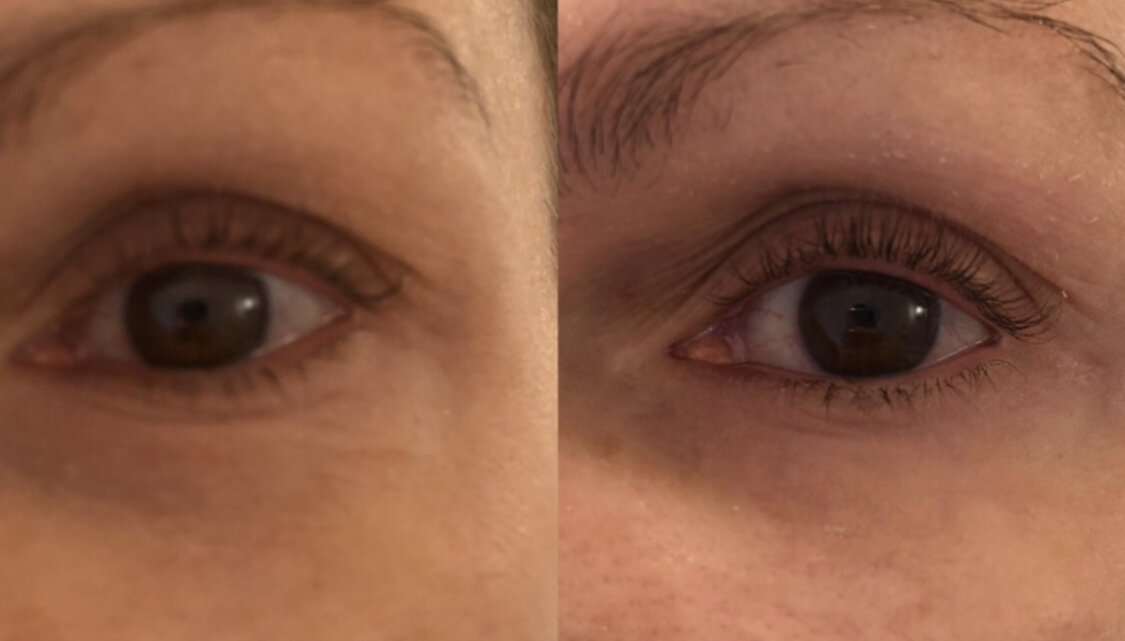 Before My Perfect Eye (left), after (right)