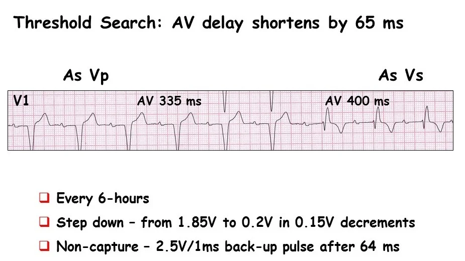 AV+delay+4.jpg