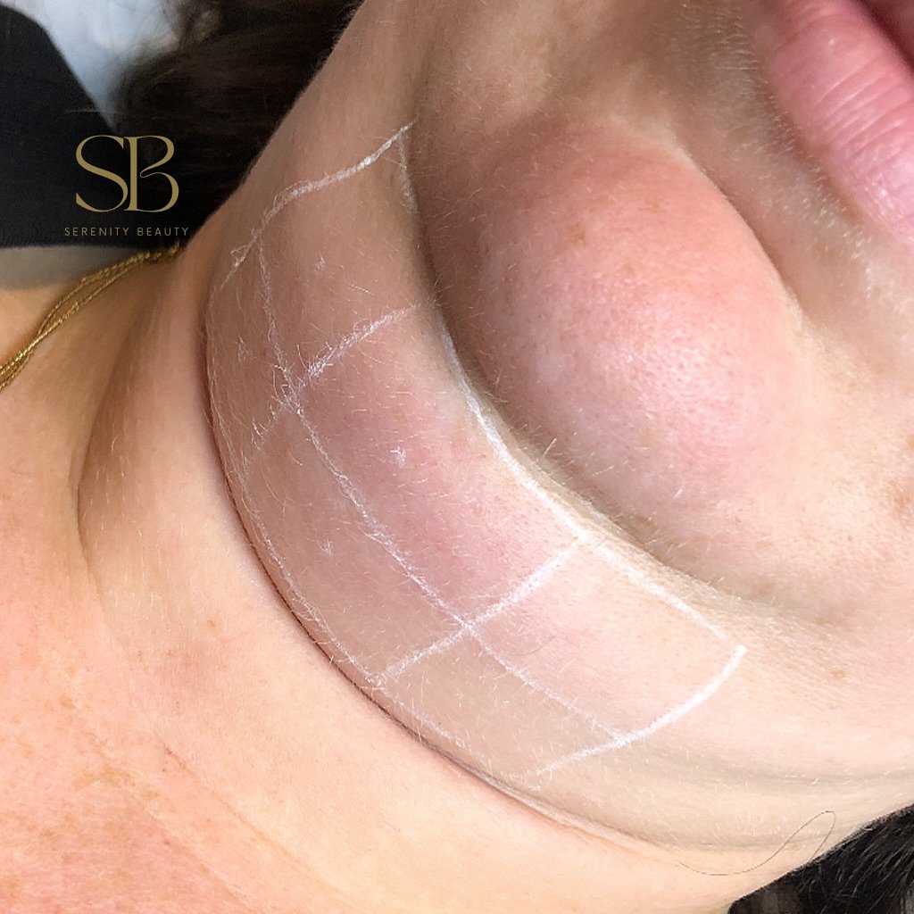 🍋🍋 When life gives you lemons&hellip;

Lemon Bottle targets and dissolves unwanted pockets of stubborn fat. The chin is an example of a popular area that can be treated to help slim the face.

www.theseremityretreat.co.uk

#lemonbottle #fatdissolvi