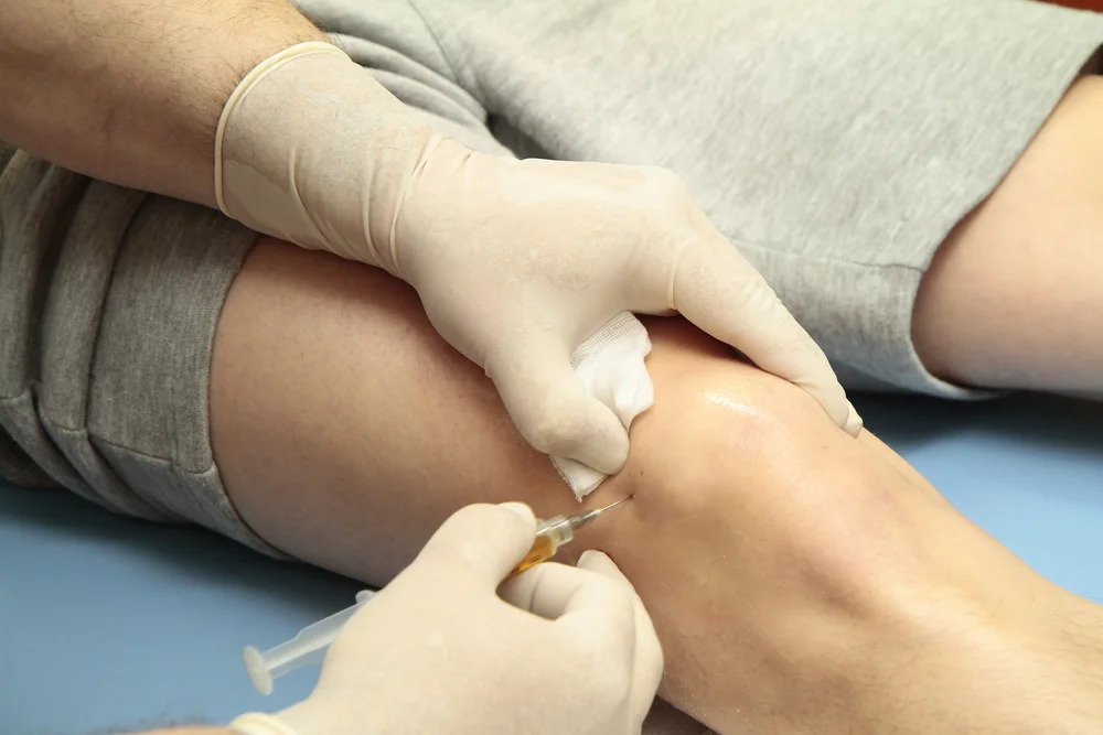 PRP injection Oklahoma City.jpg