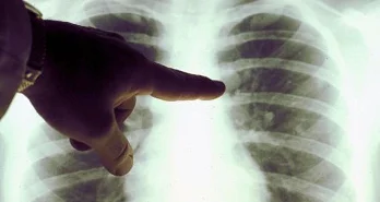 Important Information for Coke Oven Workers